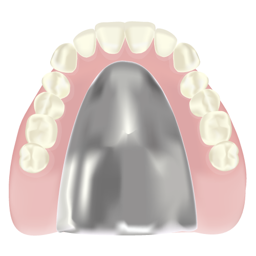 金属床の入れ歯の利点